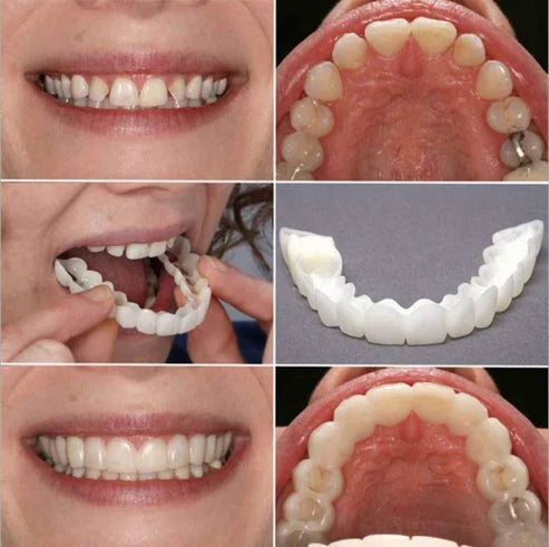 Instant and Confident on Smile Fit Flex Cosmetic Teeth Denture Teeth